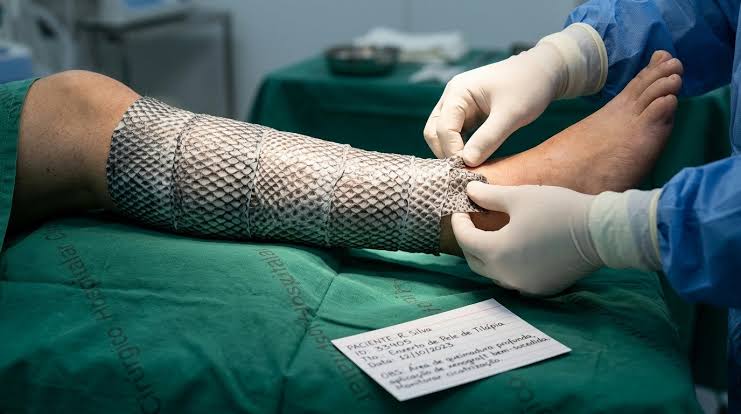 Ceará terá fábrica de pele de tilápia para tratar queimaduras